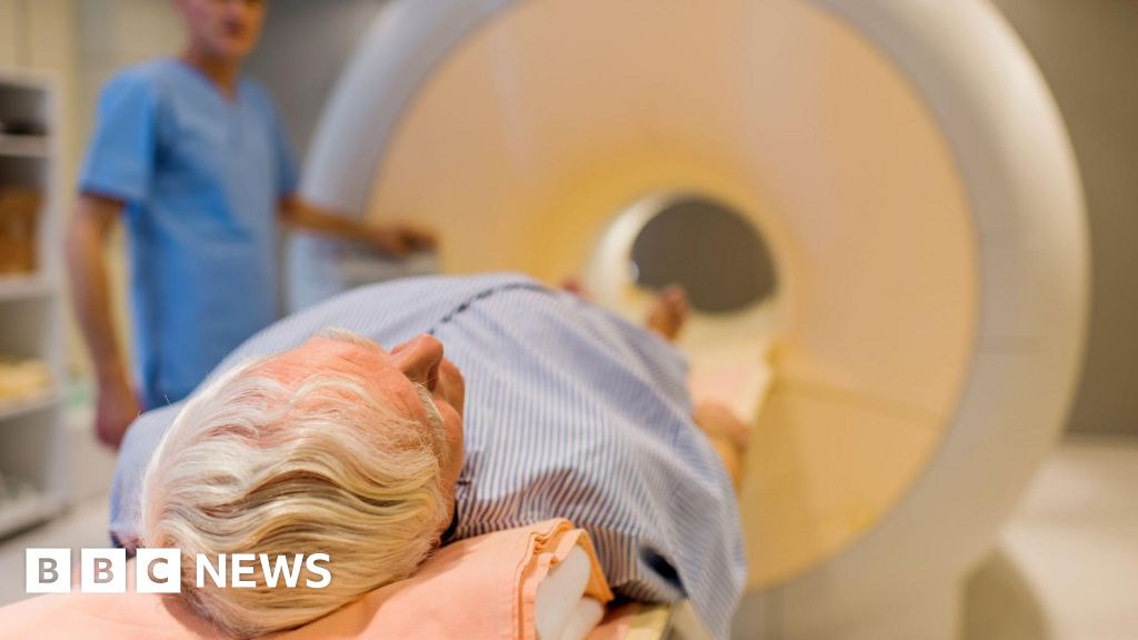 BBCFergusWalsh's tweet card. The study aims to find the best way to detect prostate cancer - the most common cancer in men in the UK.