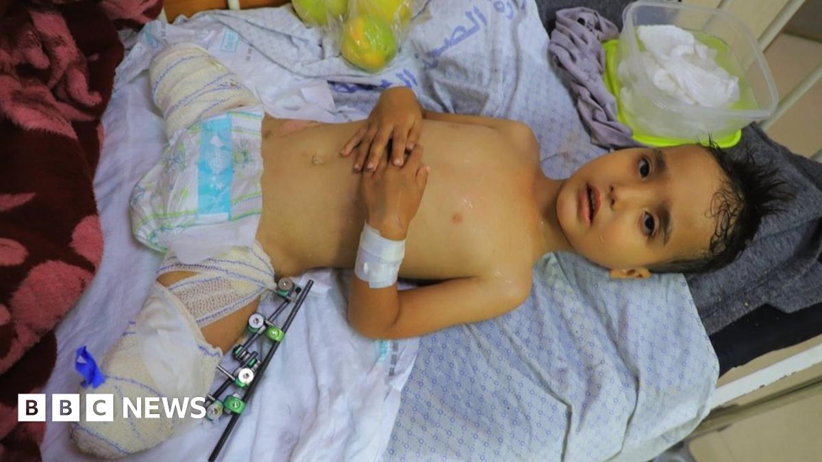 BritishIMA's tweet card. Medics in Gaza are using a unique acronym to describe children whose parents have been killed.