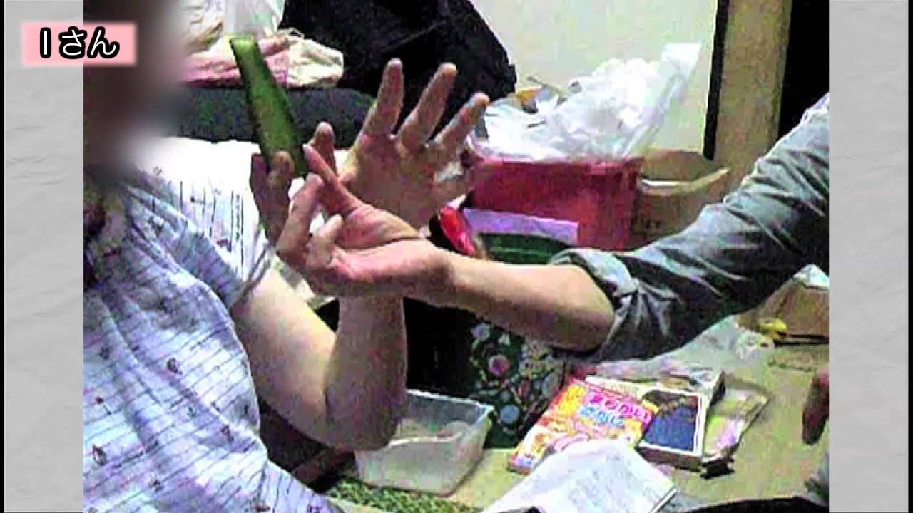 ck6kF2nQGuXlkoU's tweet card. 子宮頸がんワクチン接種後の症状