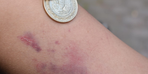 verde_cafe's tweet card. Carta a la Autoridad Detención arbitraria y agresiones en contra de 3 integrantes del Colectivo Palestina Libre Valle de Toluca y un integrante del Frente por las 40hrs del Estado de México y…