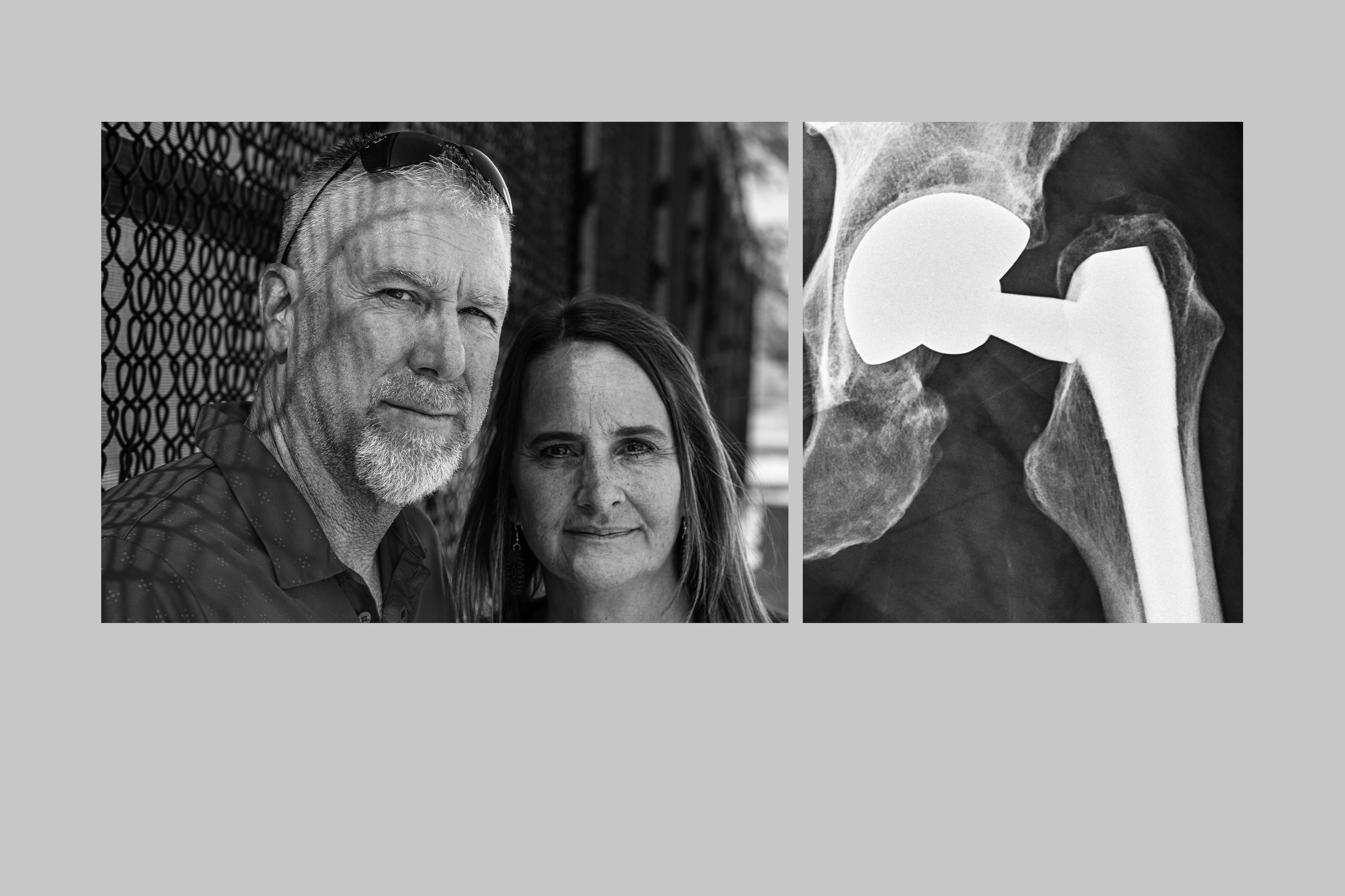 deviceproblems's tweet card. The FDA and the manufacturer were alerted to Profemur titanium hips breaking inside U.S. patients as of 2005. It took 15 years to recall the devices. Many fractures could have been avoided.