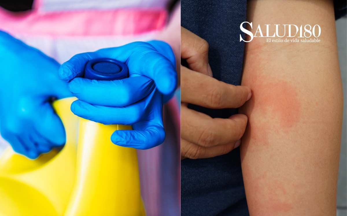 servimathec's tweet card. Es muy común que relacionemos el cloro con limpieza, pero la realidad es que el cloro puede ser muy peligroso, aquí te revelamos los riesgos y daños del cloro doméstico.