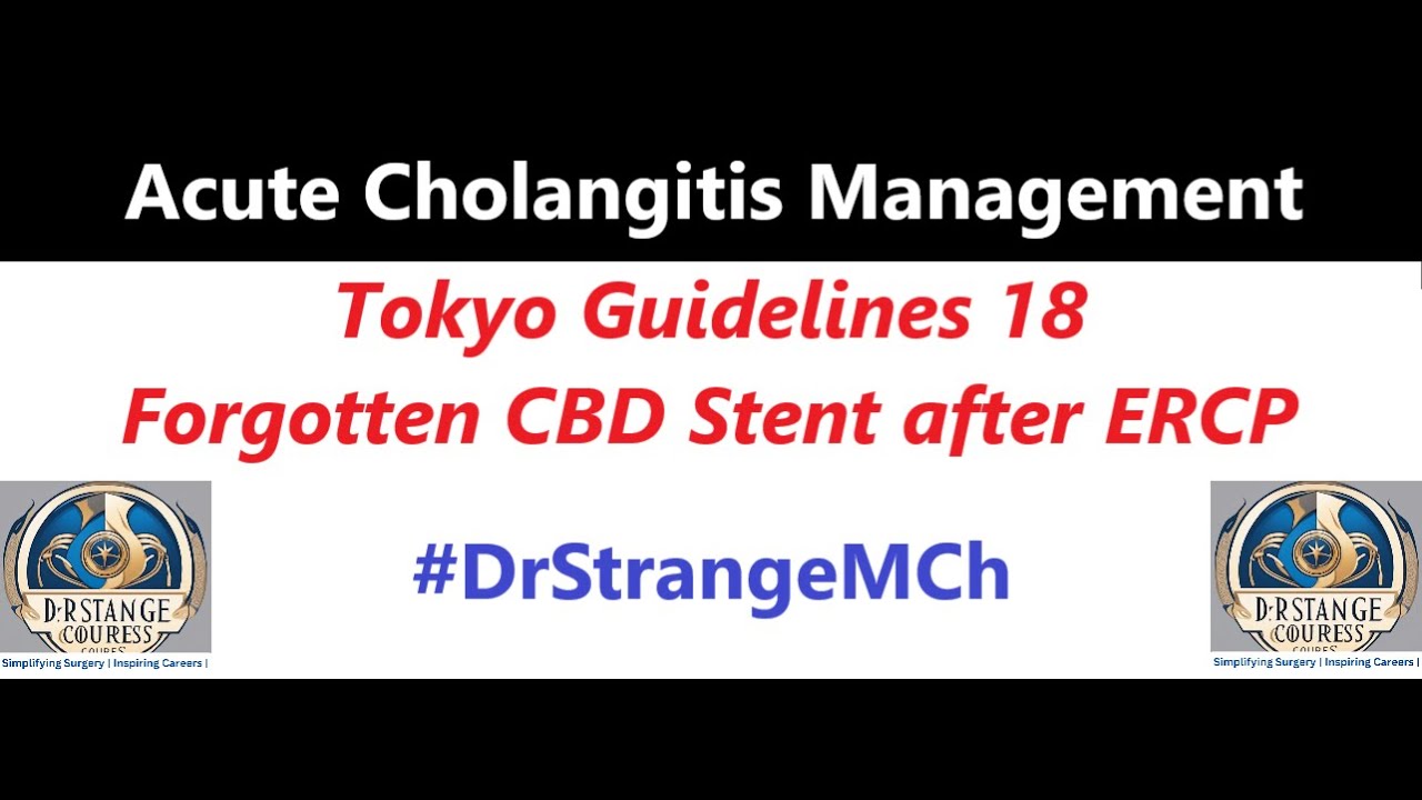 SharmaAnks08's tweet card. Acute Cholangitis Management 2025 (HDTS) | Tokyo Guidelines 18,...