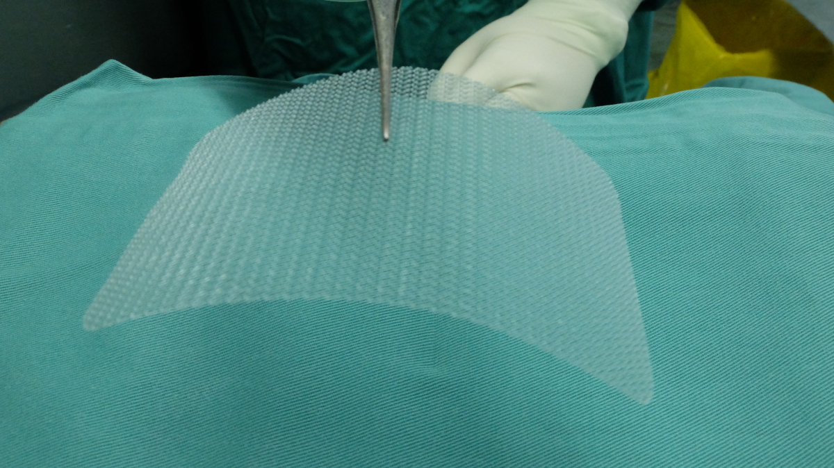 bgracely's tweet card. Istio ambient mesh is a mode that leverages a mesh data plane instead of deploying sidecar proxies, without sacrificing zero trust security.