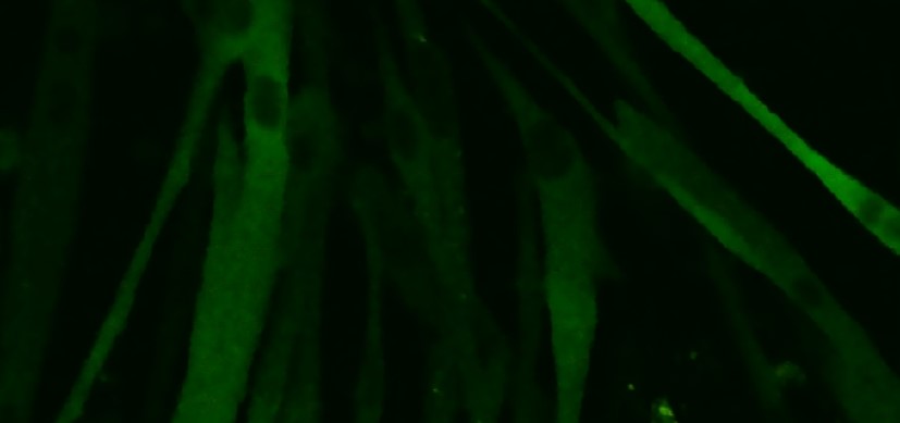 gyanesh_tri's tweet card. Surprising Insight May Put a Charge into Faster Muscle Injury Repair - Research Horizons