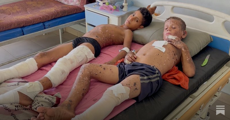 Tweet card summary image