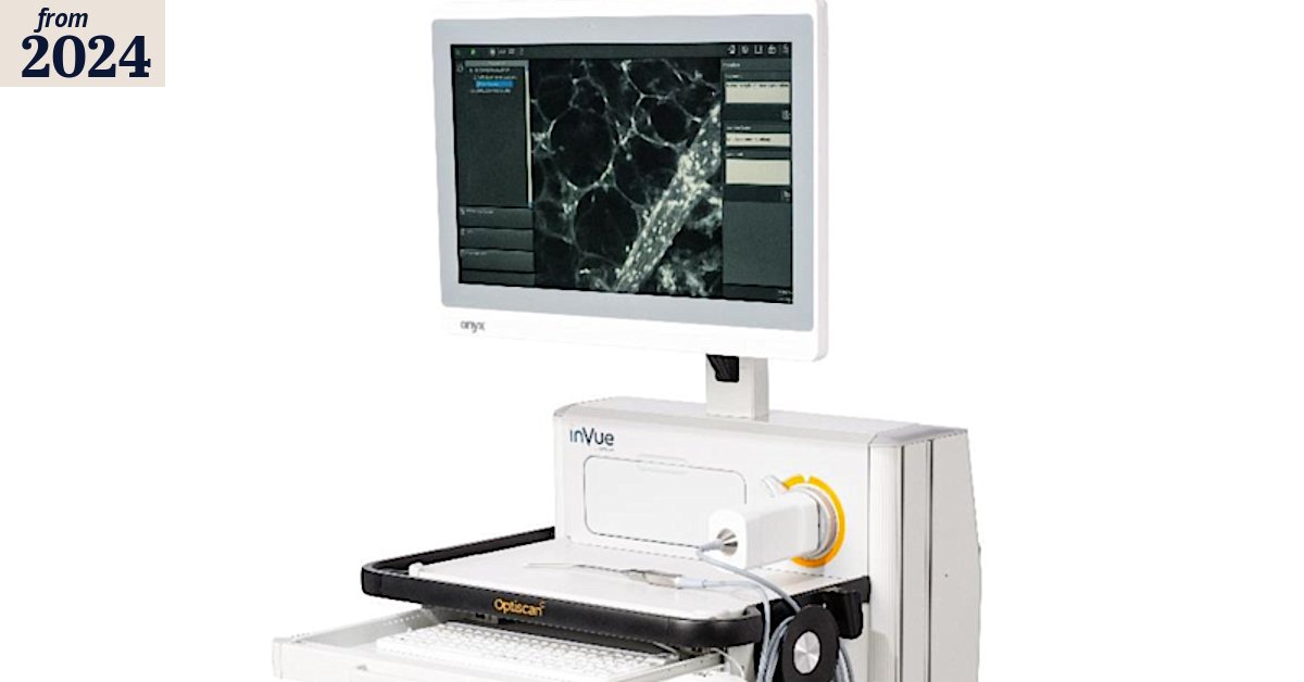 BullsNBearsWA's tweet card. Optiscan Imaging has received the nod of approval to start taking in-human images during surgery for breast cancer patients using its “InVue” technology.