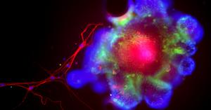 CristiLlorente's tweet card. UC San Diego scientists have found that chronic alcohol use impairs the guardrails that protect the liver from pathogens, exacerbating the liver damage caused by alcohol.