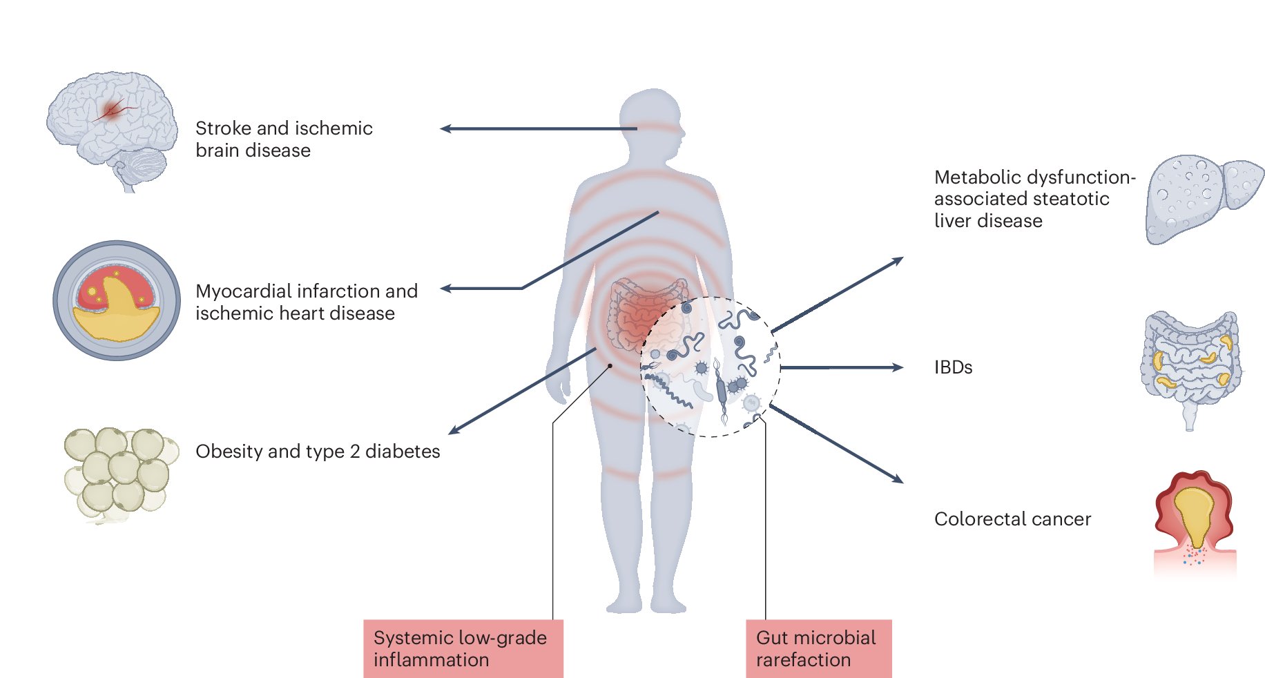 MishraaLab's tweet card. Nature Medicine - This Review outlines how Western-style diets contribute to the rising incidence of chronic, noncommunicable diseases by converging on key mechanisms, including gut microbial...