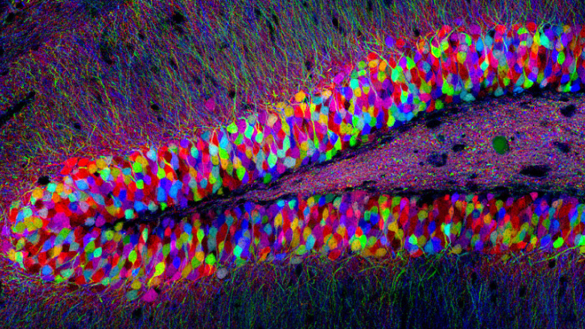 mypandor's tweet card. y triggering a single neuron, the researchers were able to force the subject to recall a specific memory. By removing this neuron, the subject would lose that memory.