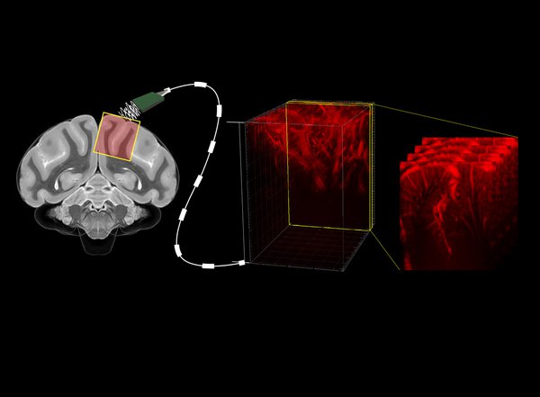 NeuroTechLDN's tweet card. A new brain imaging application developed at Caltech uses ultrasound to predict intended movements before they happen
