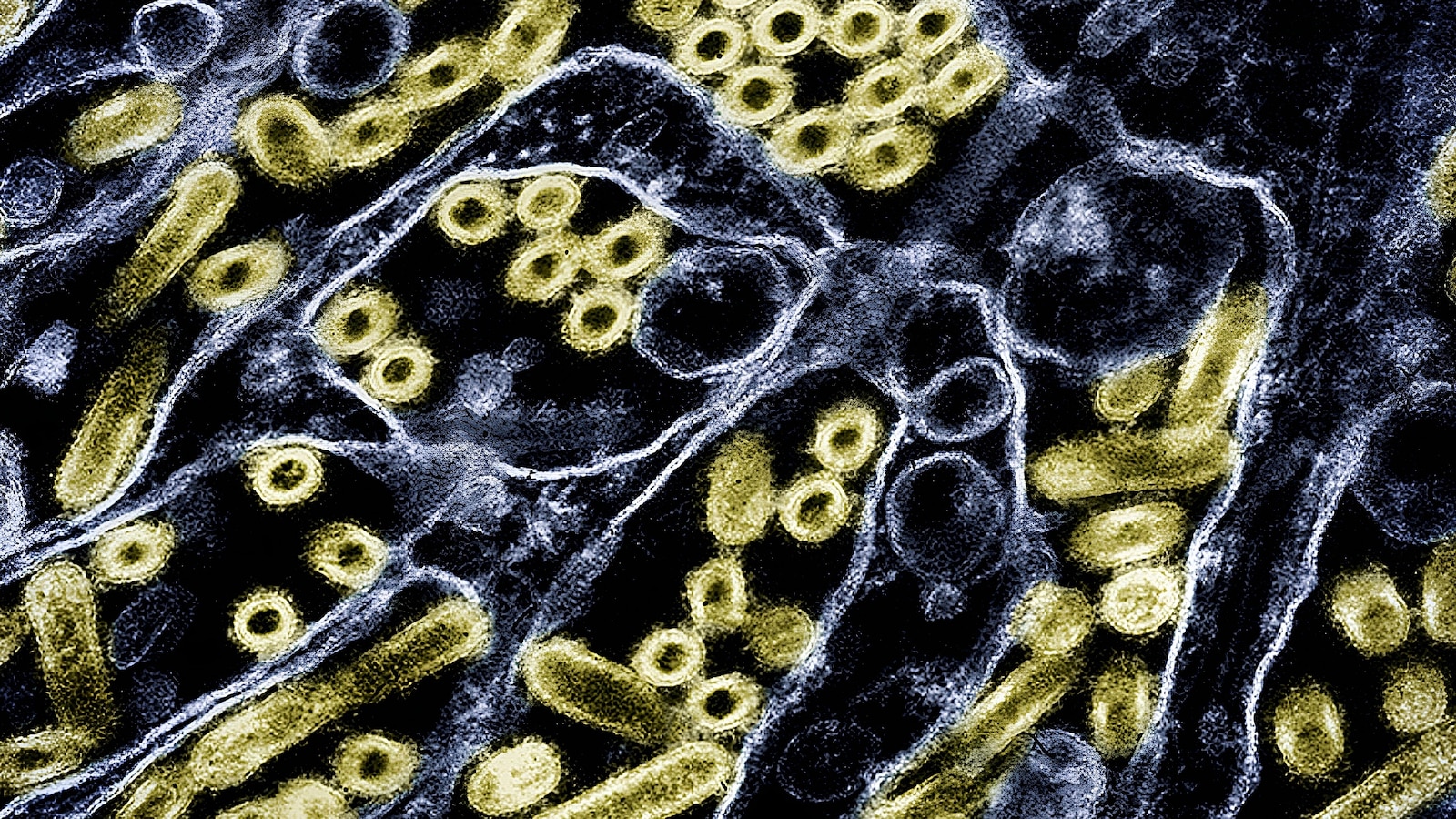 ABC's tweet card. The first human to have ever been infected with H5N5 strain of bird flu has died, Washington state health officials confirmed late Friday.