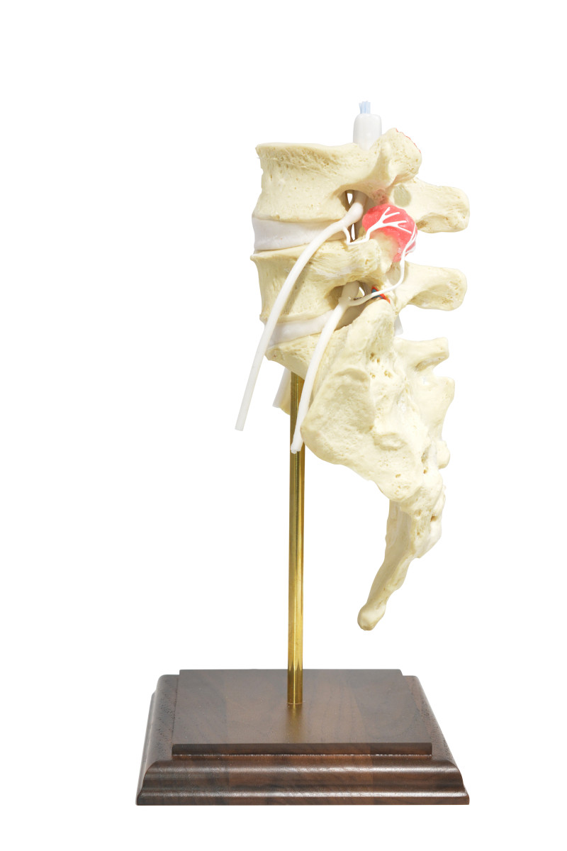 dynamicdisc's tweet card. The BMJ offers a sobering and science-based reality: most common interventional procedures for spine pain offer low or very low certainty of benefit, while carrying measurable risks and costs.