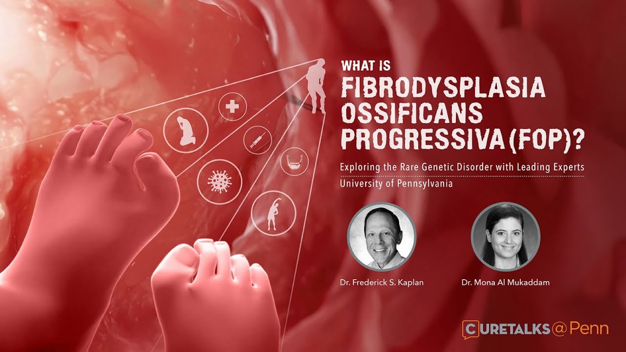 CureTalks's tweet card. What is Fibrodysplasia Ossificans Progressiva (FOP)? - Exploring the...