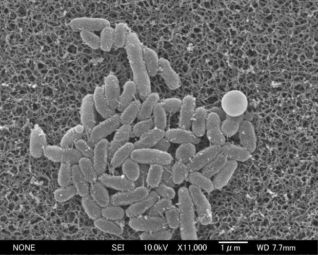 livedoornews's tweet card. 百日ぜき菌の電子顕微鏡画像（国立健康危機管理研究機構提供）記録的な流行となっている感染症「百日ぜき」を巡り、国立健康危機管理研究機構国立感染症研究所などが7〜9月に患者から採取した百日ぜき菌や検体を調