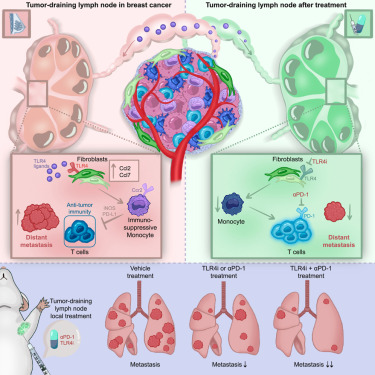 Lo_Zanzi's tweet card. Triple-negative breast cancer (TNBC) is characterized by high risks of relapse or metastatic disease. Mattavelli et al. identify a chemokine axis that recruits immunosuppressive monocytes to tumor-...