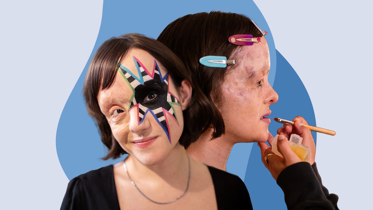 MoebiusSyndrome's tweet card. “Every time I saw a scar on screen TV, it was a villain, a vulnerable person, or a victim.”