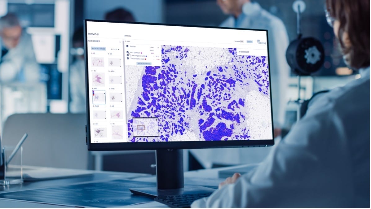 ZONTAL_IO's tweet card. Explore the future of healthcare through AI-driven treatments as Frewing et al. delve into the role of artificial intelligence in prostate pathology.