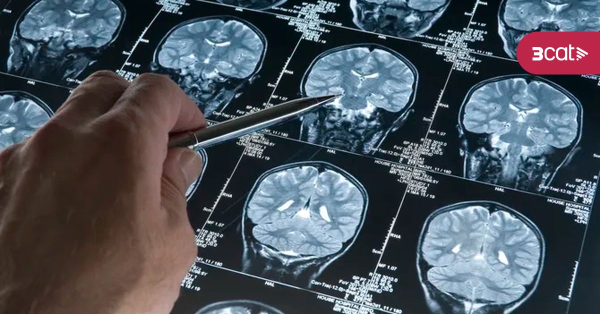 CatalunyaRadio's tweet card. Els dos primers medicaments que alenteixen l'evolució de l'Alzheimer es podrien començar a donar a les clíniques privades aquest mateix any. Ara bé, la introducció en el sistema públic serà més lenta...