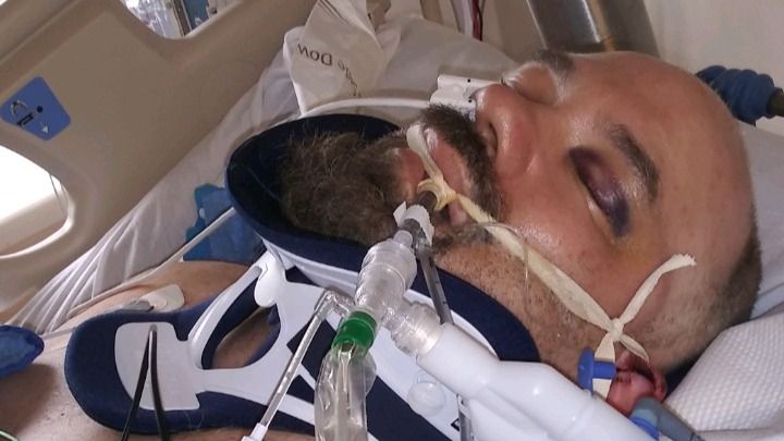 JRob1370's tweet card. JUNE 3rd 2020. Damage from Hit n Run: 14 bones in my back and 4 in my nec… Jeremy Robinson needs your support for DESPERATLY NEED YOUR HELP. HIT N RUN VICTIM.