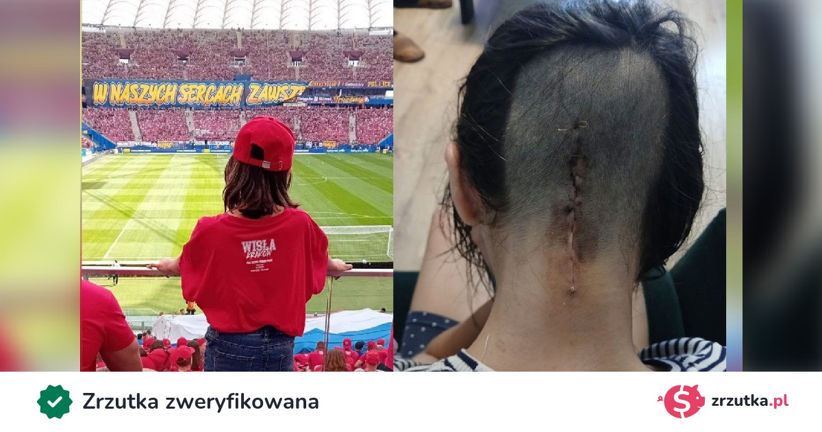 foto_kasia's tweet card. Zbieramy pieniądze na leczenie i powrót do zdrowia dla naszej małej fanatyczki.W lipcu tego roku u zaledwie 14-letniej Leny zdiagnozowano złośliwy nowotwór mózgu i rdzenia kręgowego. Nasza przyjaci...