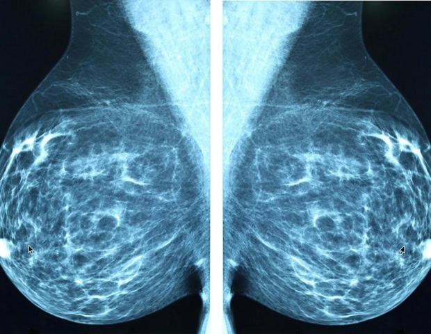 Cancer_Buzz's tweet card. Researchers at the University of California San Diego School of Medicine have identified a promising new therapy for triple-negative breast cancer (TNBC), which is among the most aggressive and...