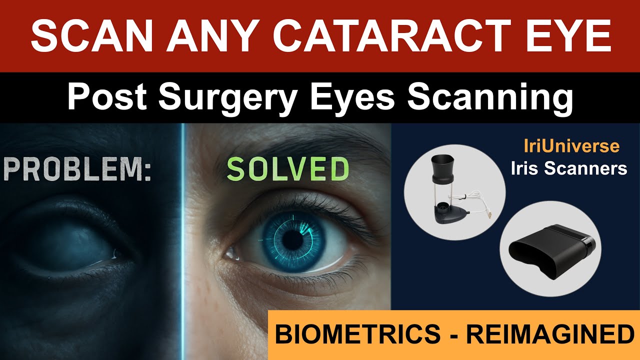 Bioenable's tweet card. IriUniverse: Iris Capture for Cataract & Post Surgery Eyes with Our...