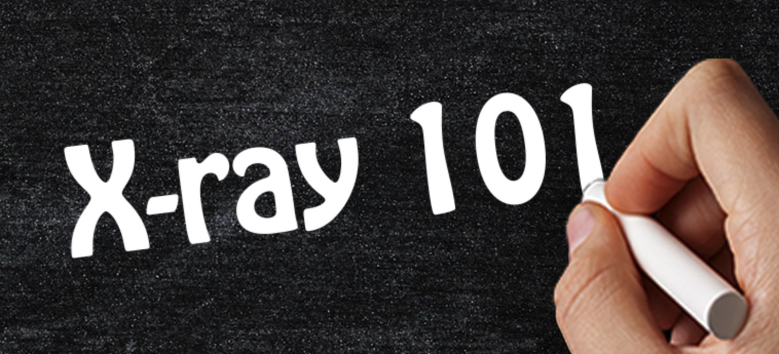 PlanAutomation's tweet card. Find out what x-rays are, the main components and operating principles of an x-ray system, and the types of foreign bodies that can be detected.