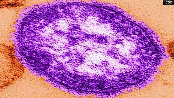 CovidDataReport's tweet card. The cases are patients less than 5 years old who recently traveled internationally.