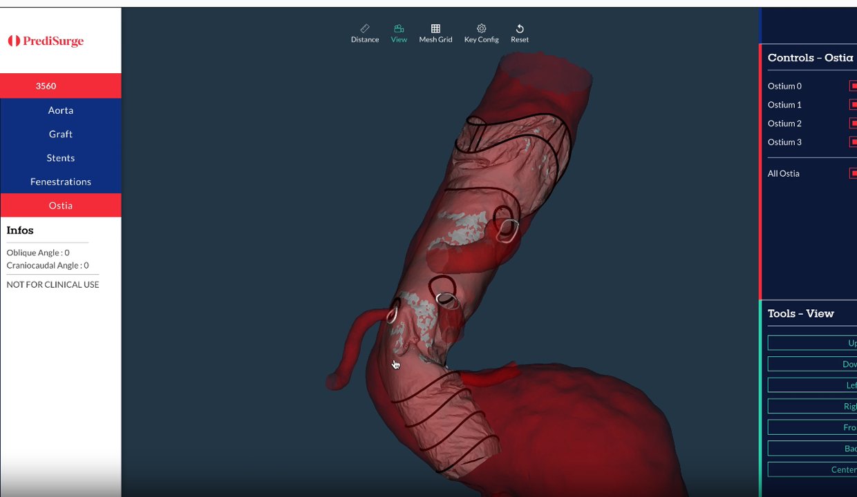 IMTechfr's tweet card. Stéphane Avril, professeur de biomécanique à Mines Saint-Étienne, explore l’entrepreneuriat pour donner une suite concrète à ses recherches.