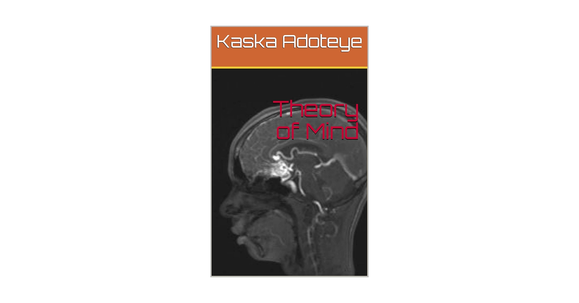 KaskaAdoteye's tweet card. At the age of 19 I was diagnosed with a rare brain disease called an arteriovenous malformation (AVM) that can kill me at any moment. By reading this body of work you will learn more about me than I...