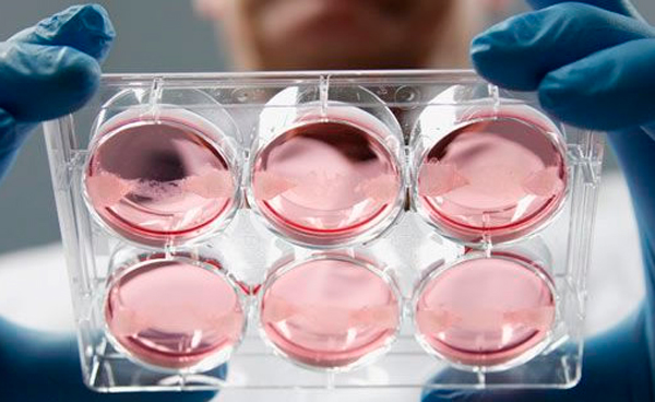 CABLENOTICIAS's tweet card. Células madre: alternativa en la medicina regenerativa y la salud articular