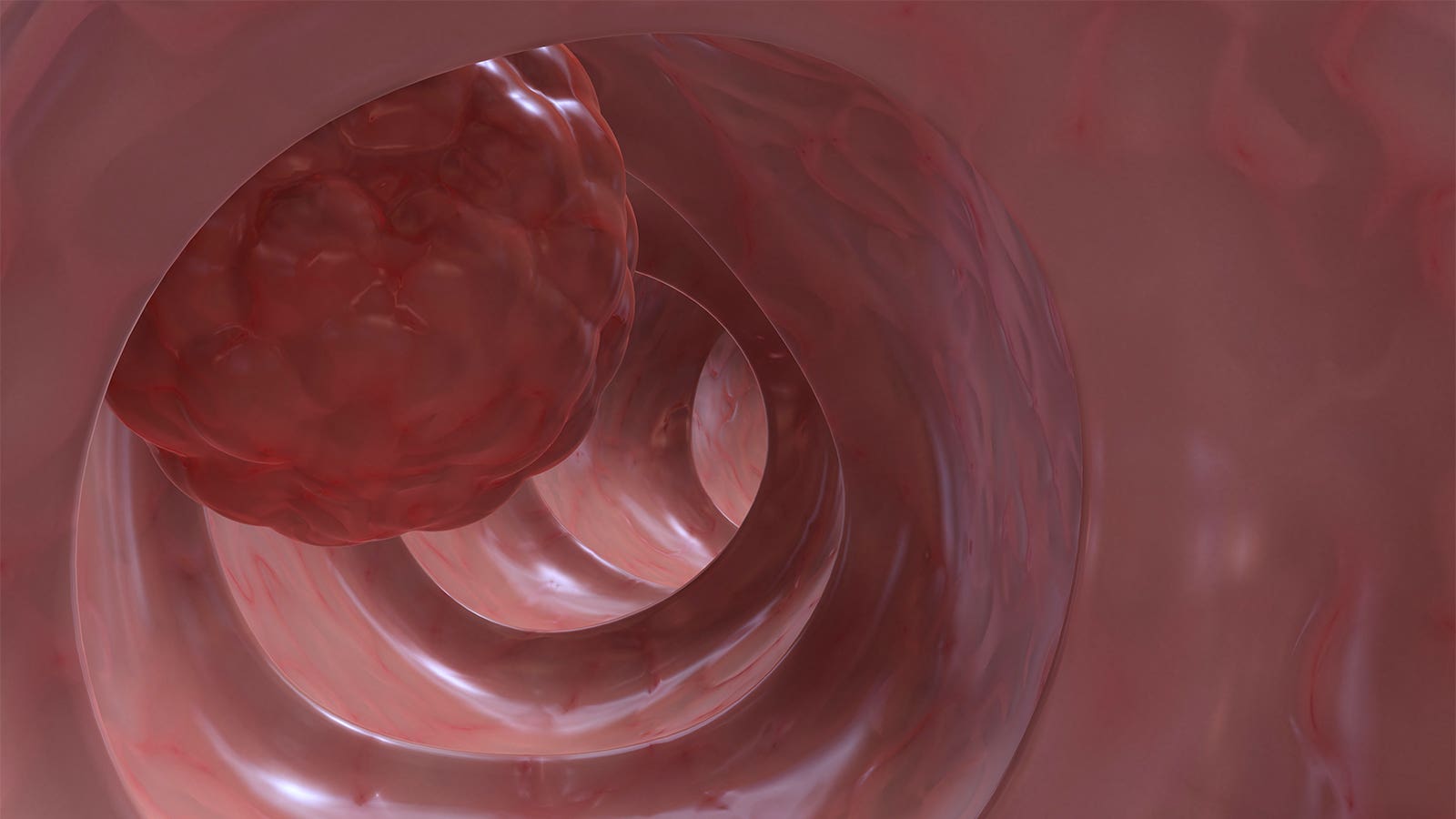 Loose_Lab_Rat's tweet card. 5-year mortality rate more than twice as high in patients not treated with the obesity drugs