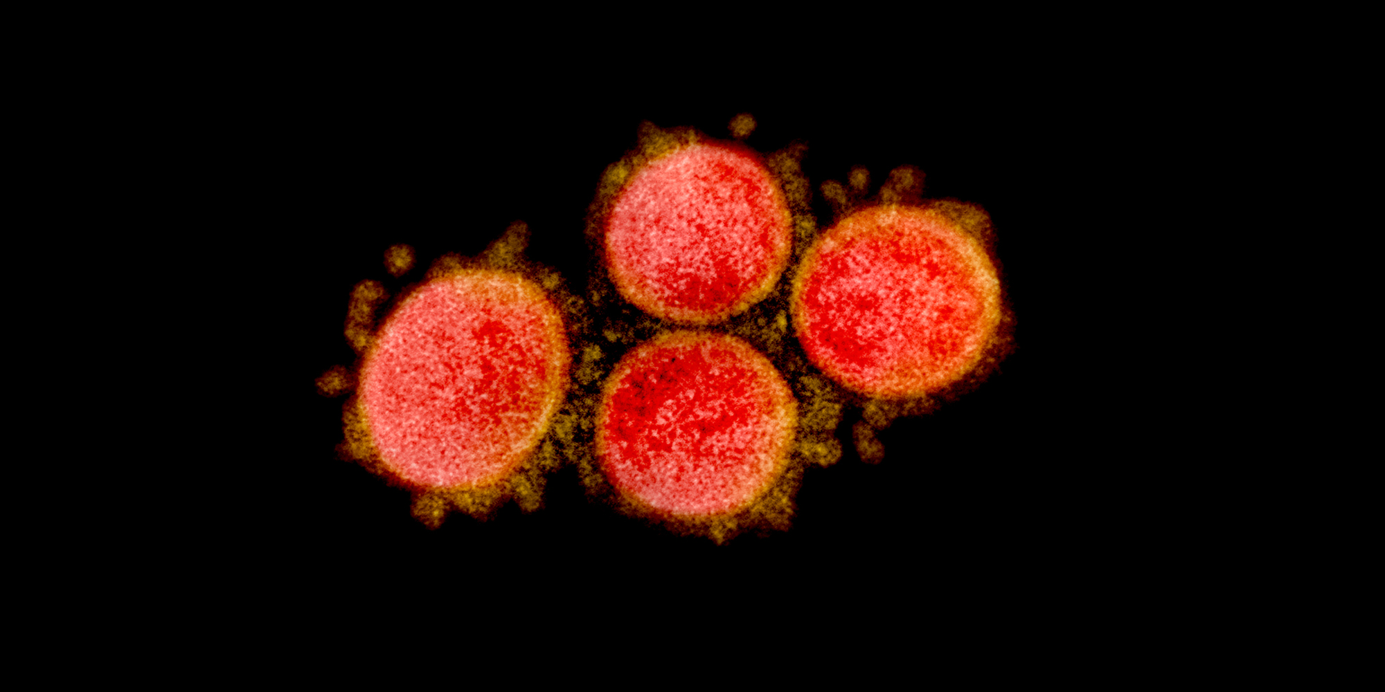rickybobby1569's tweet card. The proposal, rejected by the U.S. military’s research agency DARPA, describes the insertion of human-specific cleavage sites into bat coronaviruses.