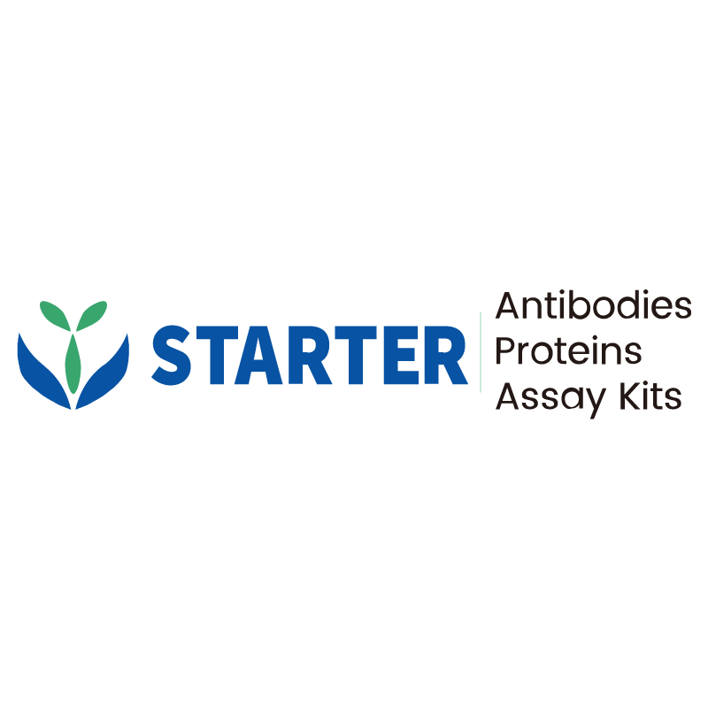 AntBio_'s tweet card. Product Specification Application IHC-P Reactivity Hu Physical Appearance Liquid Storage Buffer PBS, 40% Glycerol, 0.05% BSA, 0.03% Proclin 300 Stability & Storage Primary antibody:12 months from...