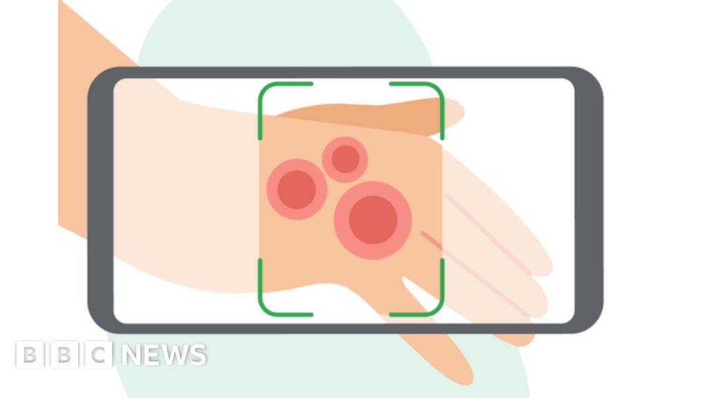 RoxanaDaneshjou's tweet card. The tech giant says its "dermatology assist" tool can recognise 288 different skin ailments.