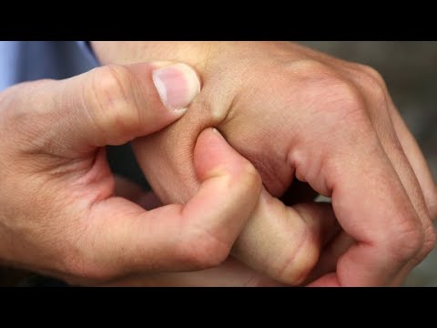 ClassicsFellow's tweet card. Would you get 'microchipped' at work?