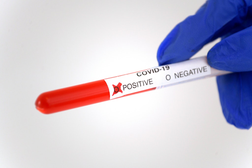 berlinerzeitung's tweet card. Nach Angaben der SPD-Fraktion erhielt ein Mitglied einer anderen Fraktion sein Testergebnis kurz zuvor telefonisch.