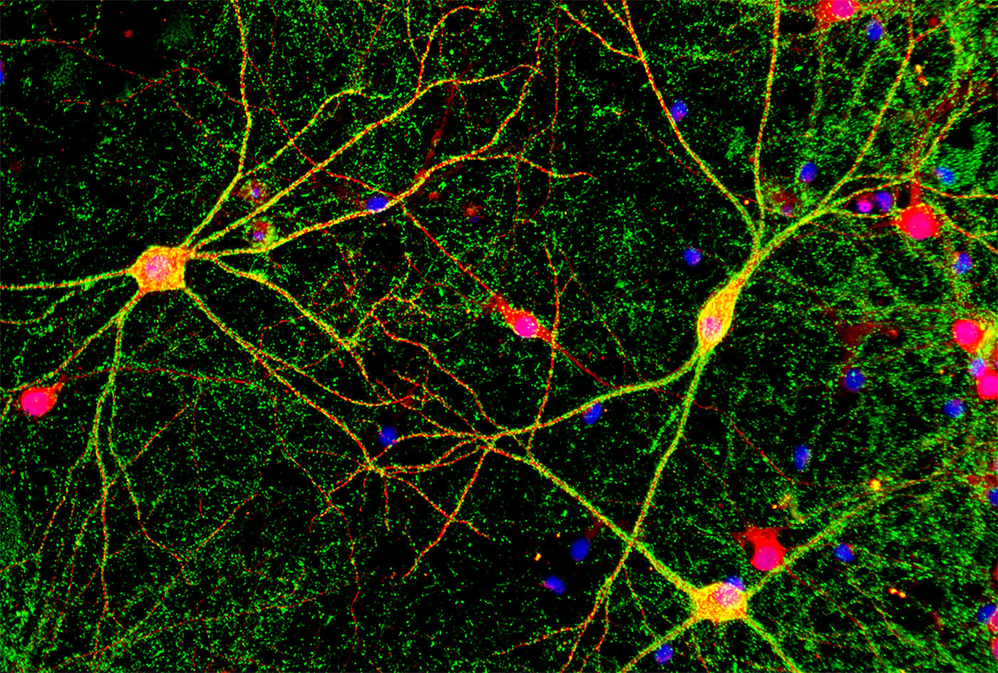 GENbio's tweet card. Stem cells differentiated into brain and neural organoids may help scientists understand both brain development and neurodegenerative disease progression.