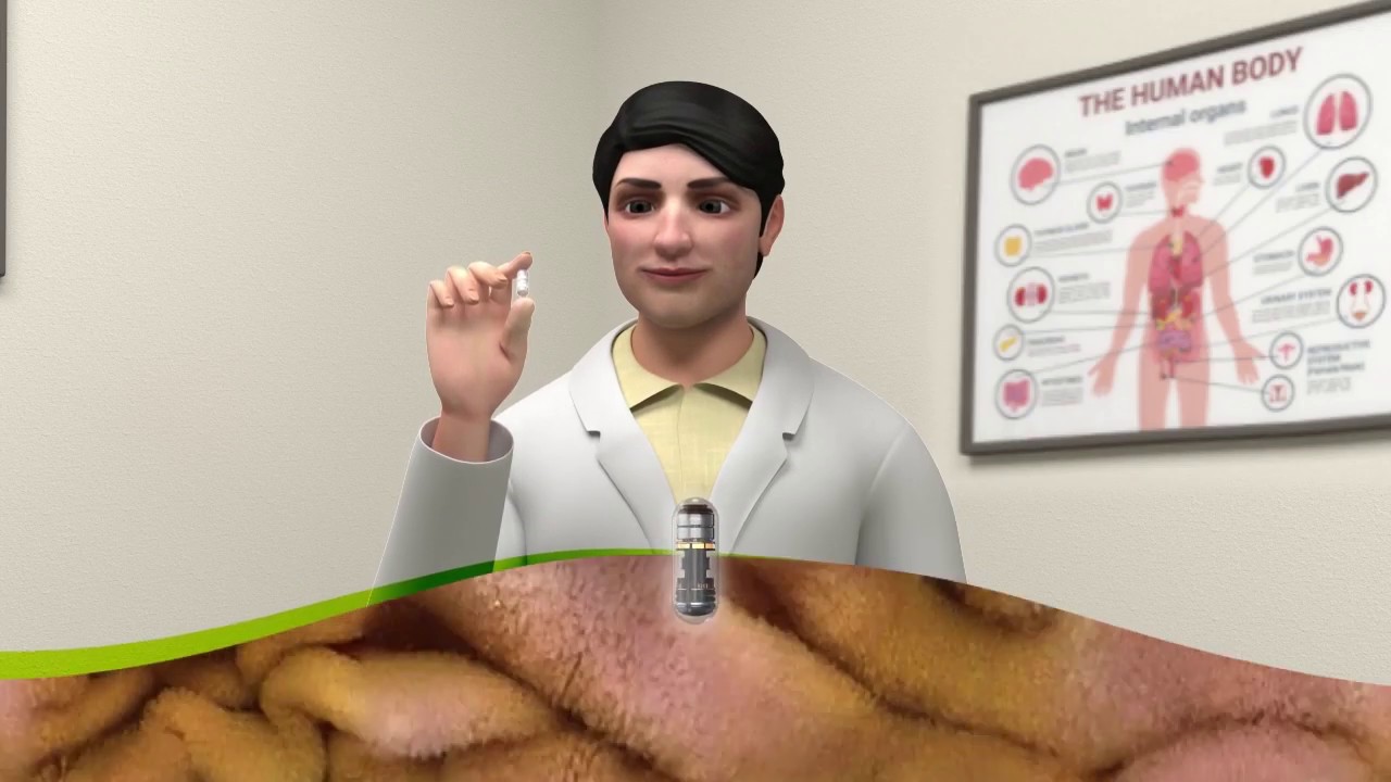 CapsoVision's tweet card. How does capsule endoscopy work?