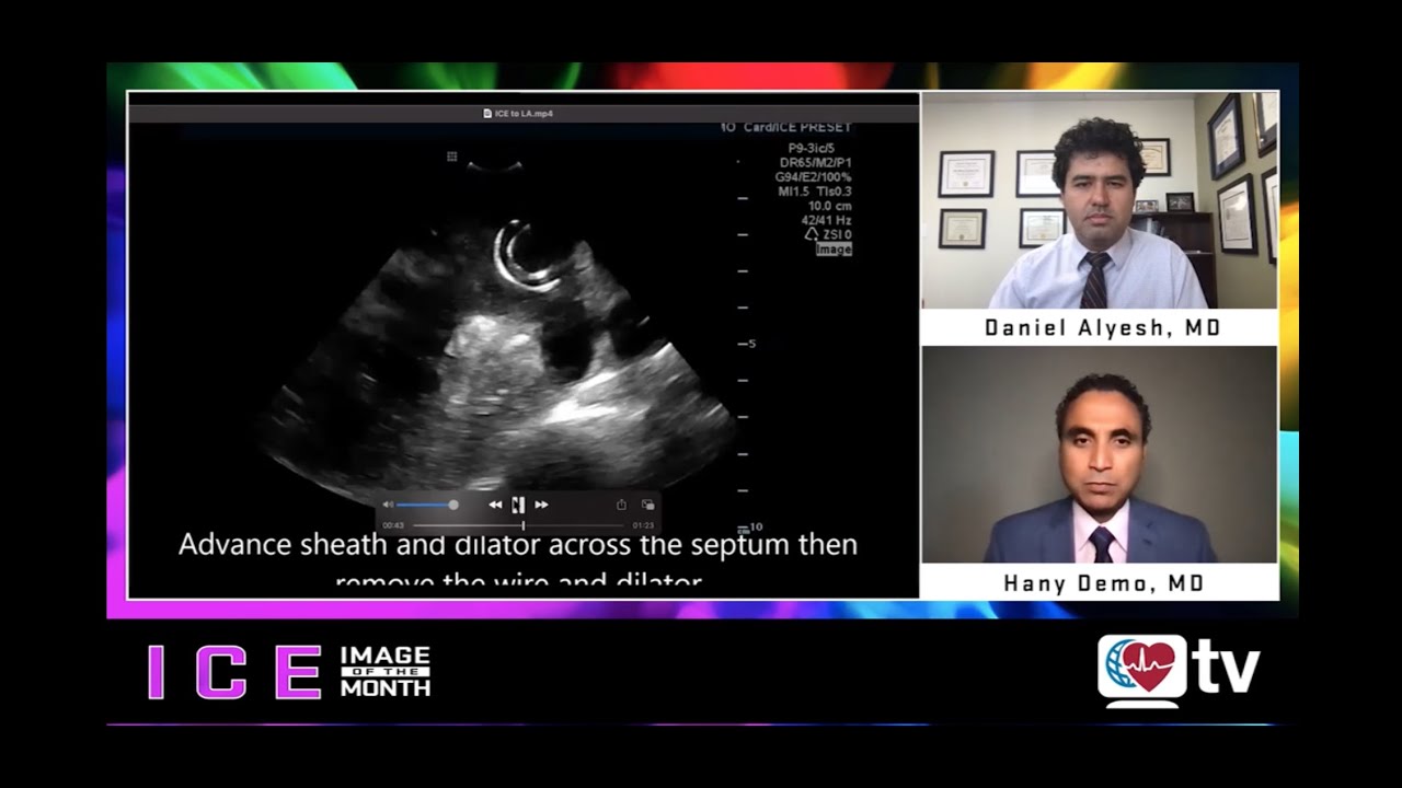 HeartRhythmTV's tweet card. ICE Image of the Month Part I (Sept 2021): A Conversation with Hany...