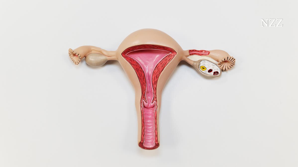 ElsaKoester's tweet card. Bei der Endometriose wandern Zellen aus der Gebärmutter in den Bauchraum und lösen dort Beschwerden aus. Neue Erkenntnisse deuten darauf hin, dass die Krankheit durch eine Infektion begünstigt wird....