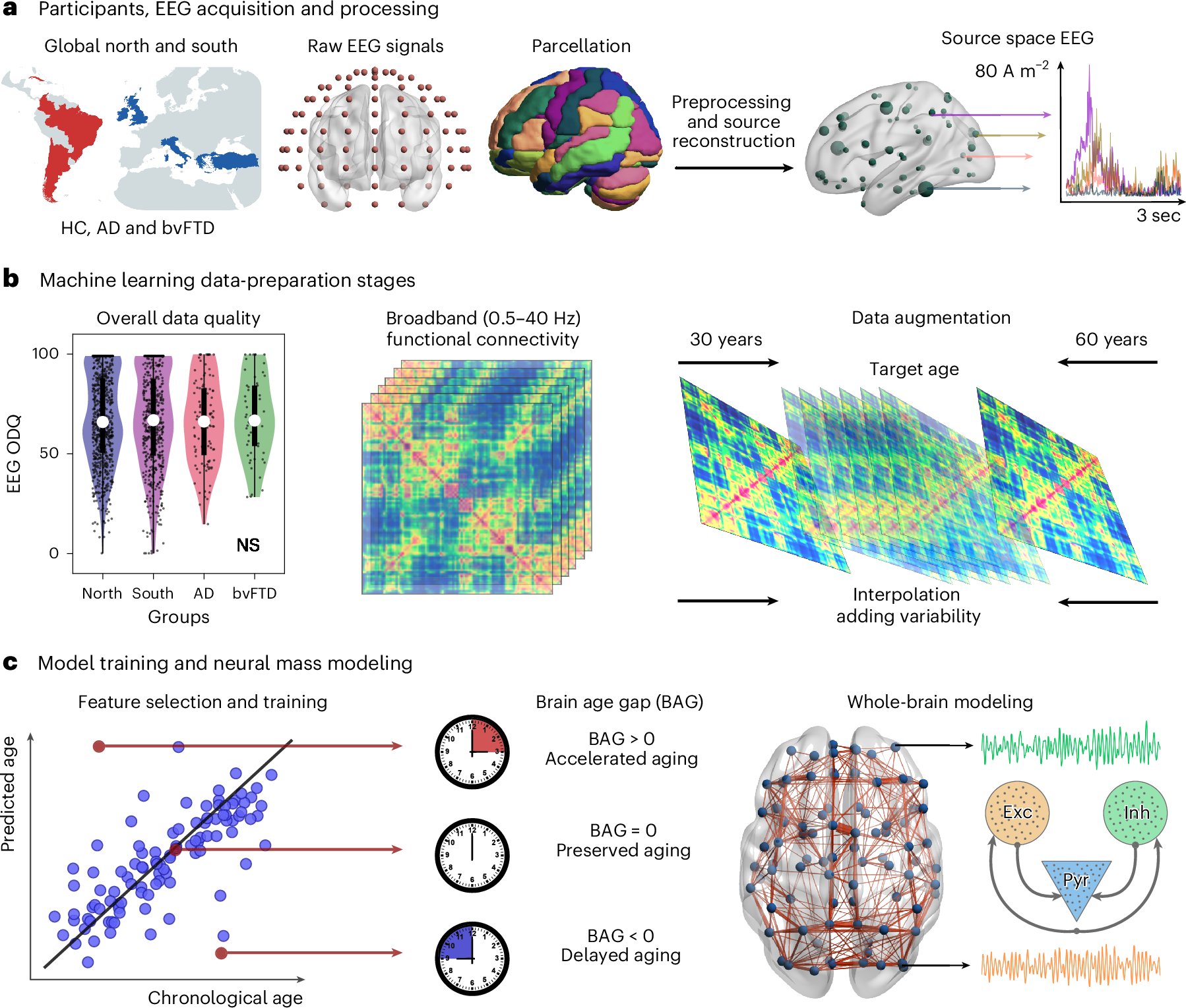 NatMentHealth's tweet card. Nature Mental Health - Brain age gaps (BAGs) highlight deviations from healthy brain aging, yet their biophysical underpinnings in aging and dementia are not well understood. Here, the authors use...