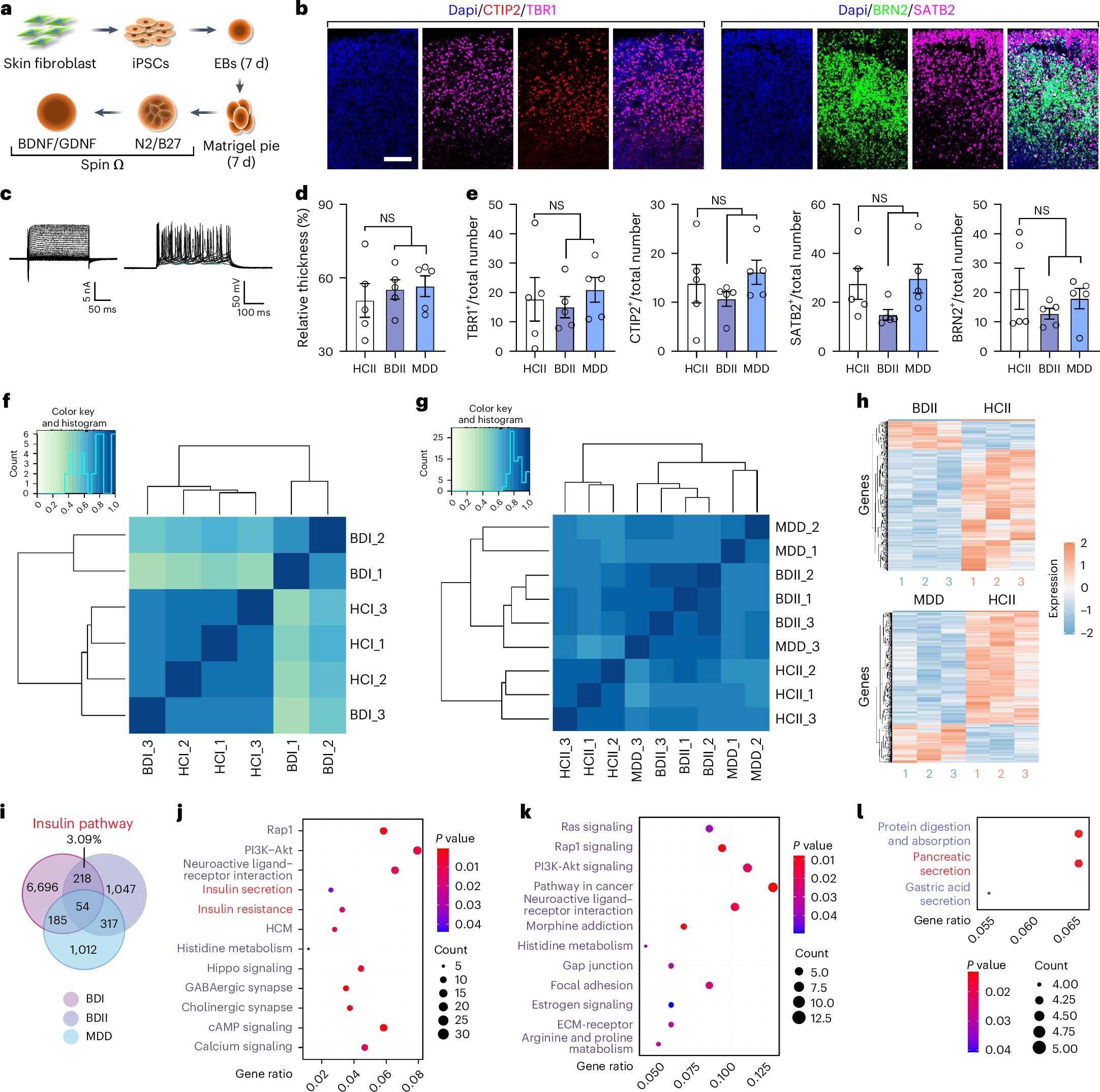 zenbrainest's tweet card. Nature Neuroscience - The mechanisms linking neuropsychiatric and metabolic disorders remain unclear. The authors show a pancreas–hippocampus feedback loop whereby metabolic and circadian...