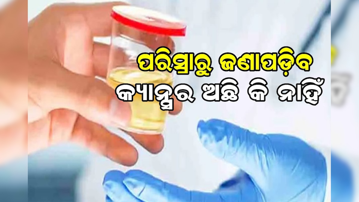News18Odia's tweet card. New Urine Test: କର୍କଟ ଏକ ଗମ୍ଭୀର ରୋଗ ଯାହା ଯେକୌଣସି ବ୍ୟକ୍ତିଙ୍କୁ ହୋଇପାରେ। ଏକ ନୂଆ ଅଧ୍ୟୟନରୁ ଜଣାପଡିଛି ଯେ ପରିସ୍ରା ମାଧ୍ୟମରେ ମଧ୍ୟ କର୍କଟ ରୋଗ ନିଶ୍ଚିତ କରାଯାଇପାରିବ। ଆସନ୍ତୁ ଜାଣିବା ଏହା ବିଷୟରେ...