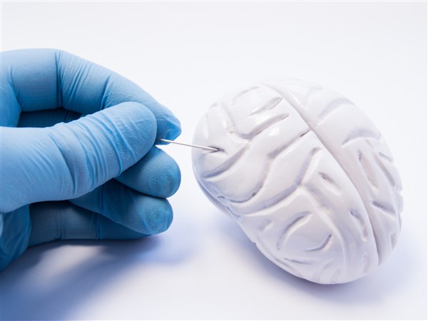 thebraindriver's tweet card. Dr. Alastair Hoyt is a neurosurgeon at the University of Toledo Medical Center. He earned his doctorate of medicine from the University of Nebraska Medical ...