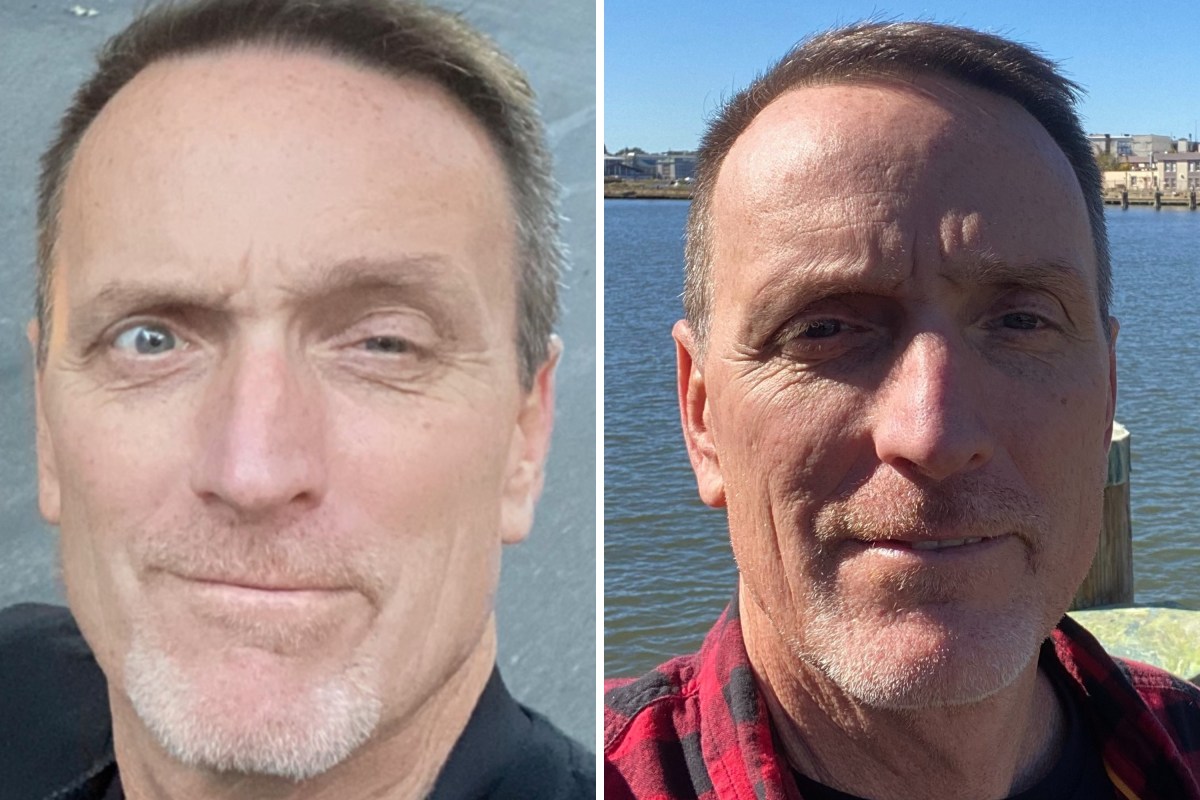 UMDNsgyChair's tweet card. My neurosurgeon warned me my condition would only get worse.