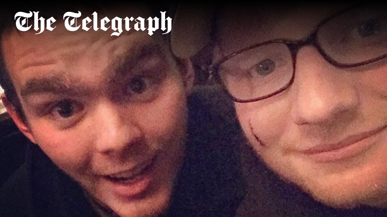 adamalexanderw's tweet card. Princess Beatrice cut open Ed Sheeran's face in a mock-knighting of James Blunt that went wrong, it has been reported.