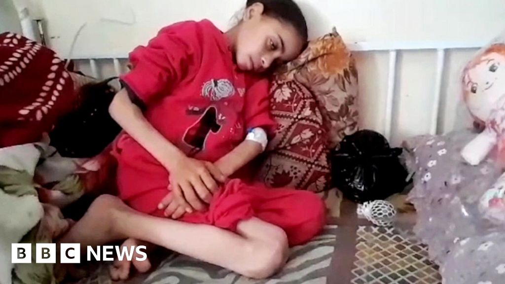 BBCWorld's tweet card. Volker Türk tells Jeremy Bowen there is a "plausible" case that Israel is using starvation as a weapon of war.