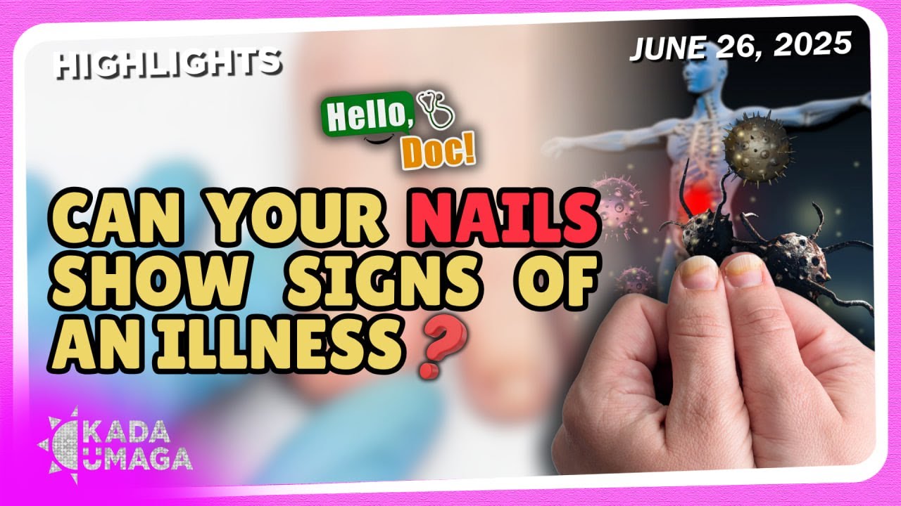 NET25TV's tweet card. Bakit delikado ang discoloration ng kuko?